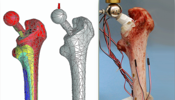 דוגמת ניסוי על עצם ירך עם משתל