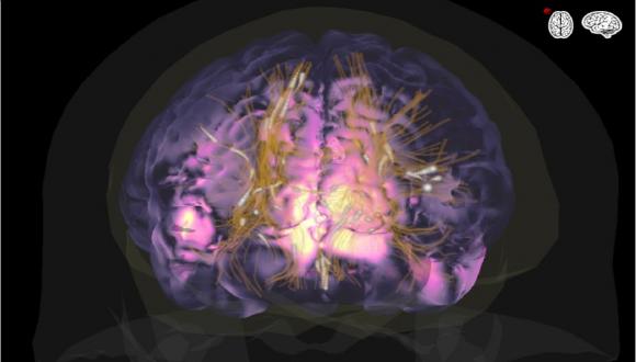 סמינר “RECENT ADVANCES IN COMPUTATIONAL ELECTROMAGNETICS FOR HIGH RESOLUTION NEUROIMAGING” סמינר “RECENT ADVANCES IN COMPUTATIONAL ELECTROMAGNETICS FOR HIGH RESOLUTION NEUROIMAGING”